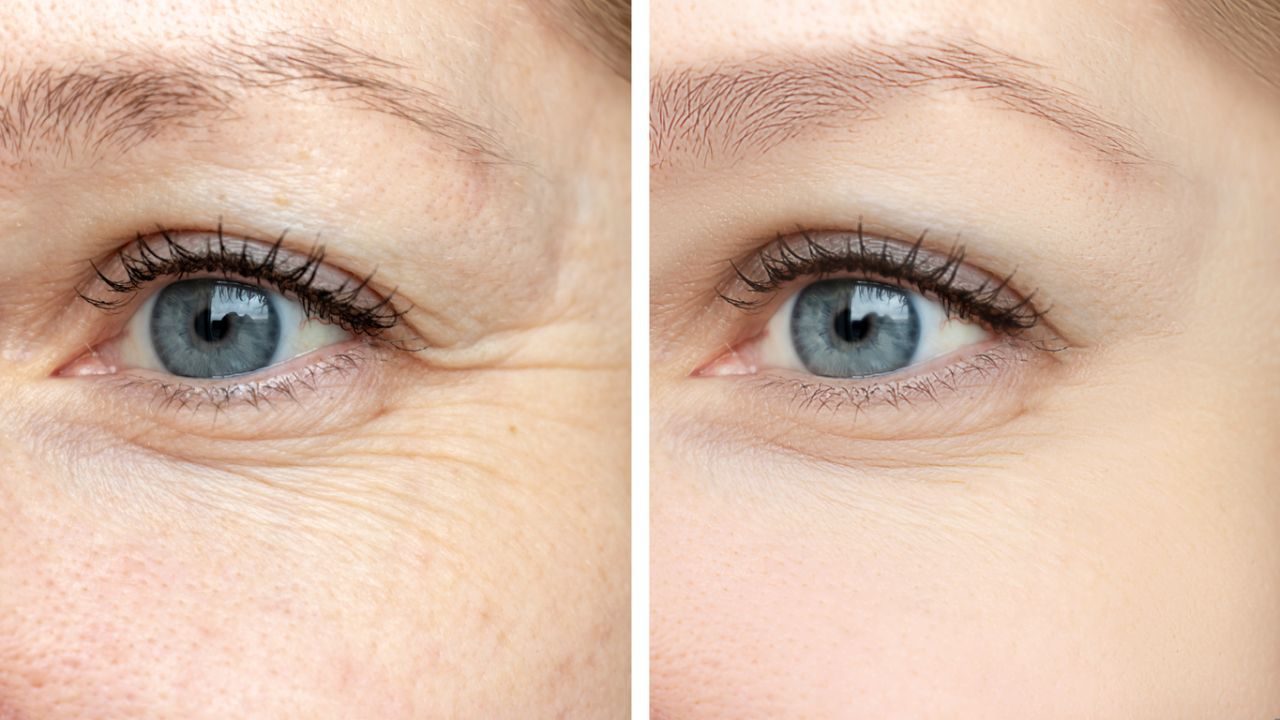 Reduces Fine Lines and Wrinkles